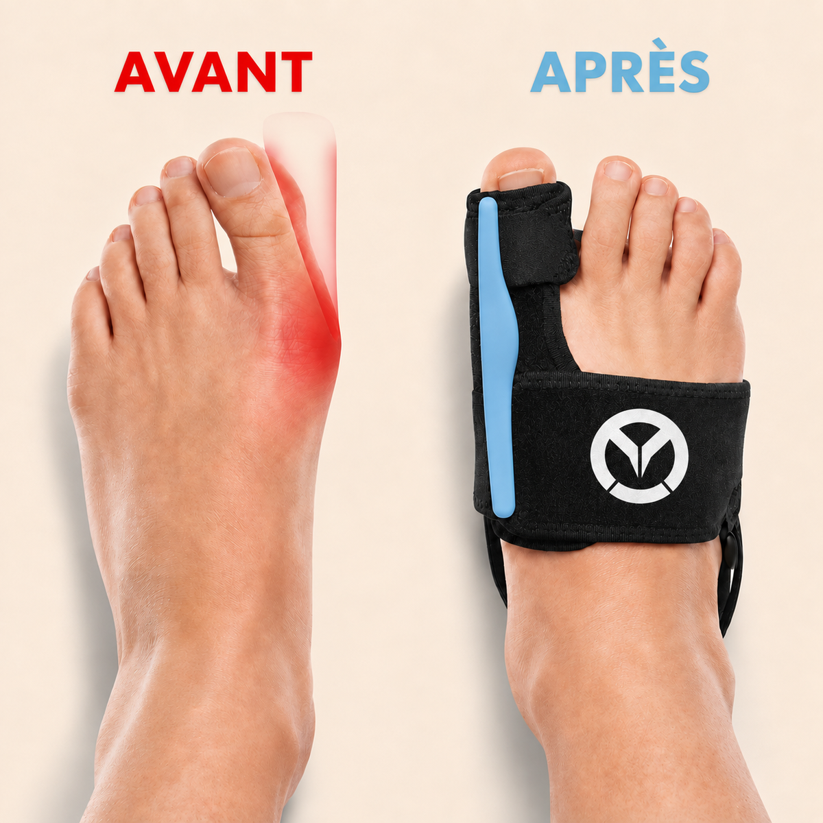 Valgux™ Attelle | Correcteur d'hallux valgus (oignon du pied)